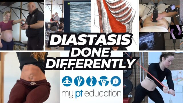 Diastasis Done Differently